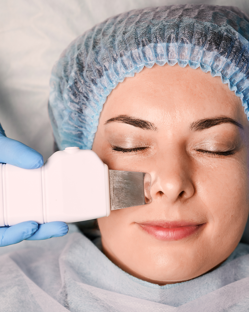 High Frequency Facial for Hormonal Acne