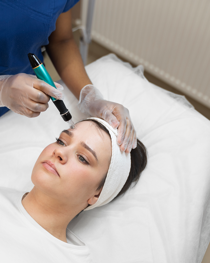 Microneedling Facial Treatment