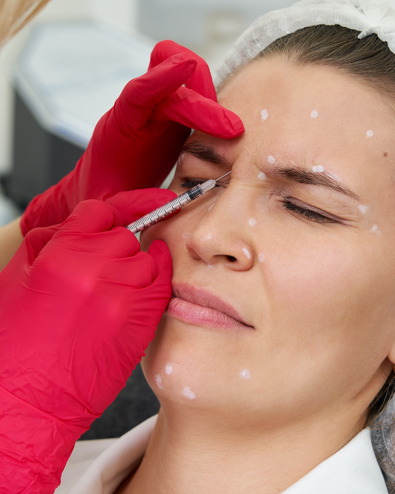 Lumi Eyes Injectable Polynucleotide Course of  Session